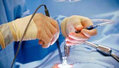 UPTH to Prioritize Minimal Access Surgeries over Orthodox Procedure 7 Minimal Invasive Surgery