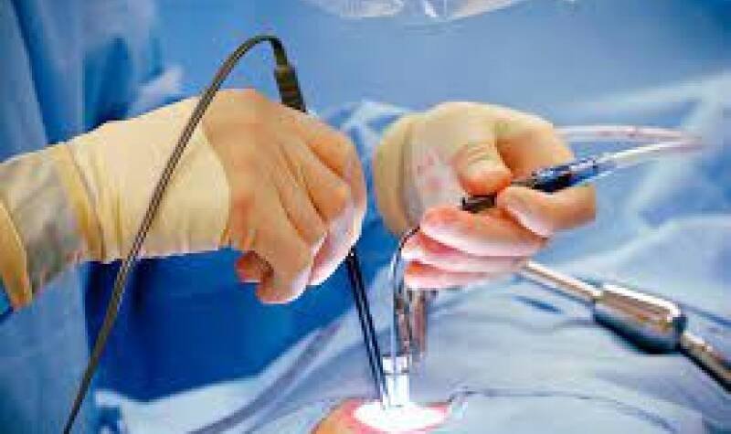 Minimal Invasive Surgery